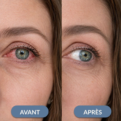Soulagez vos yeux secs et irrités en 5 minutes par jour, sans gouttes